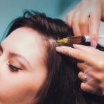 Hairfall Treatment